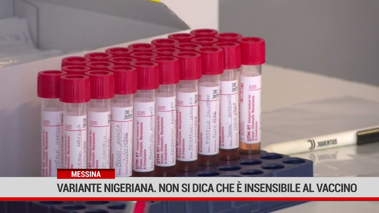 Messina. Variante nigeriana. Non si deve dire che è insensibile al vaccino